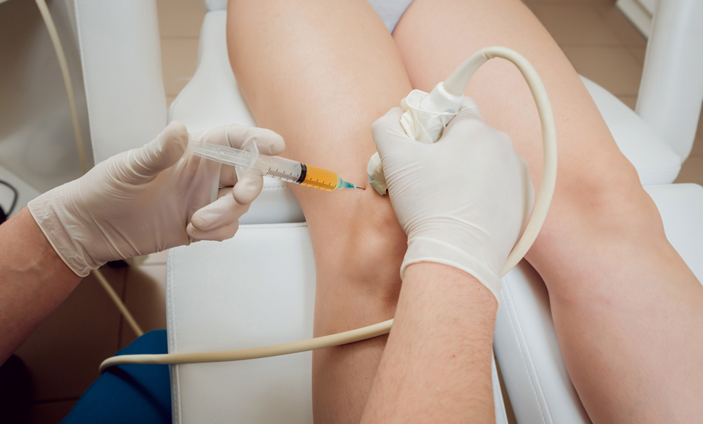 injection-prp-genoux